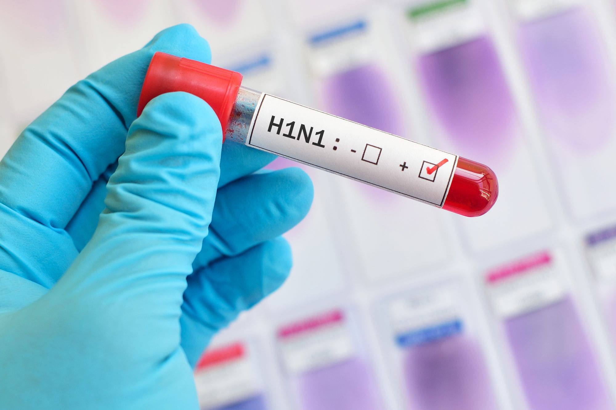 El virus de la gripe H1N1 (gripe porcina)